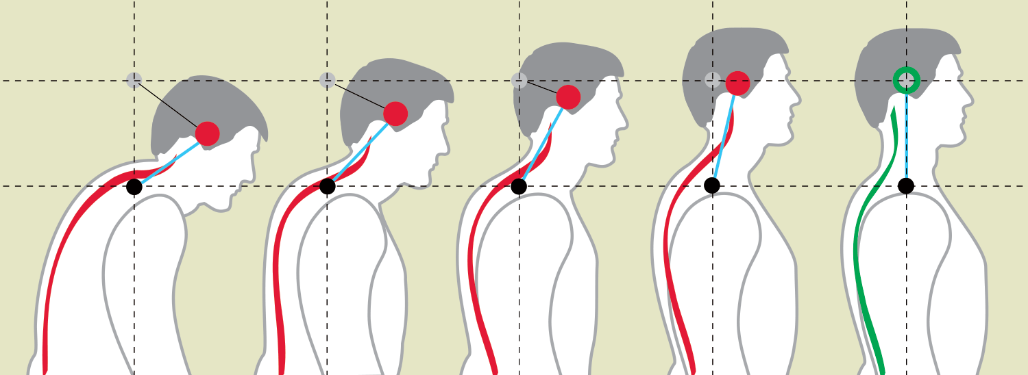 Read more about the article Align Posture and Relieve Back Pain with Chiropractic
