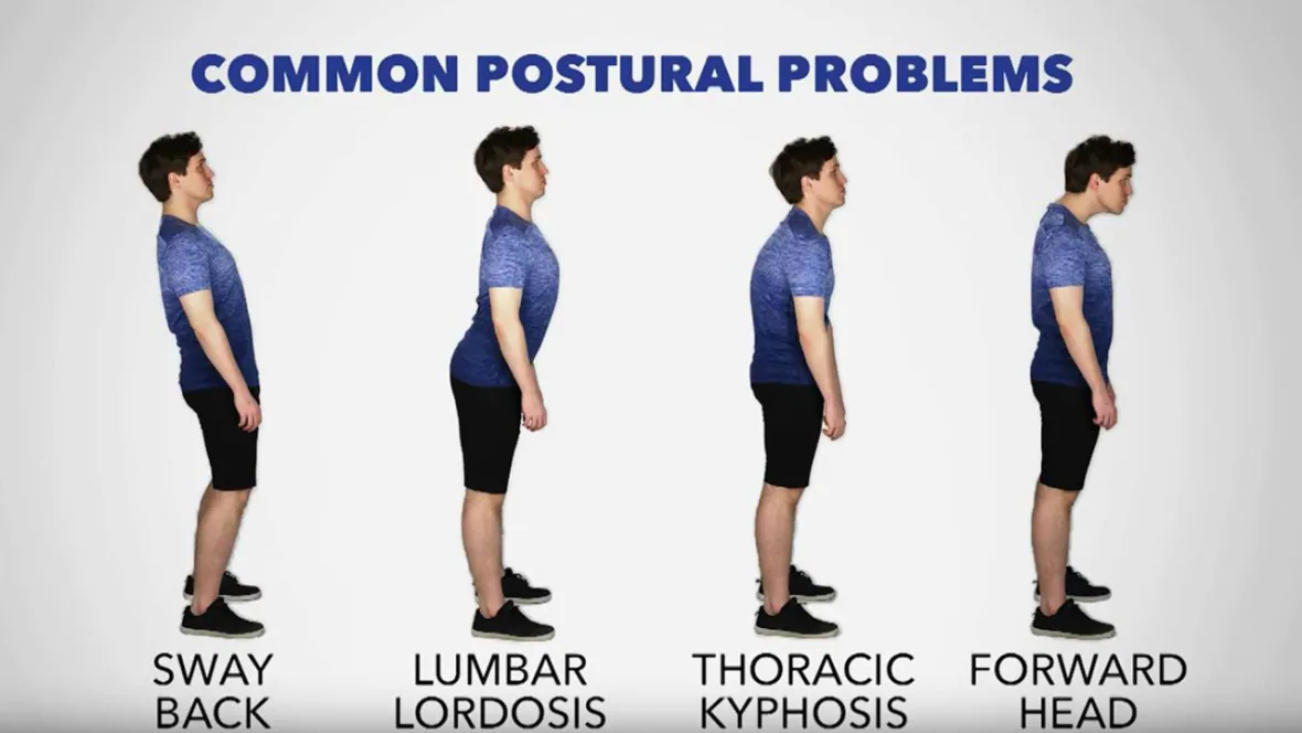 Read more about the article Your Posture Defines Your Health