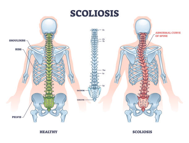 You are currently viewing What Chiropractic Care Can Do for Scoliosis